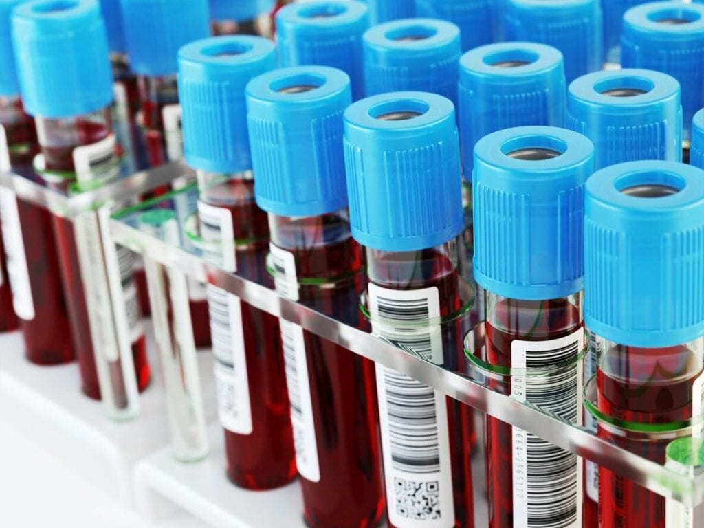 Blood Test Defenses DUI Blood Test Defenses - Orange County